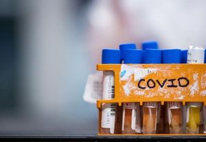 中国新冠疫苗两针600，加拿大会免费接种吗？